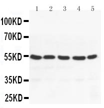 WB - Anti-PPAR Gamma Antibody ABO10645